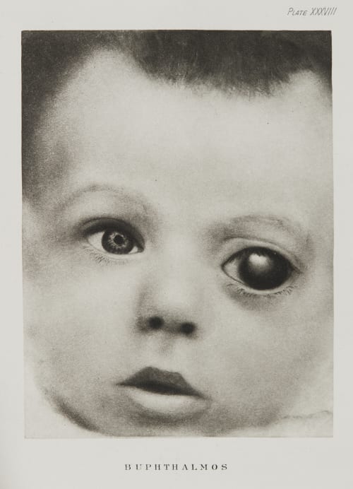 Plate XXXVIII, Buphthalmos Ramsay, A Maitland  (Scottish, 1859-1946)