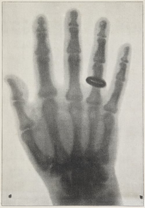 La Decouverte du Dr. Roentgen Roentgen, Wilhelem  (German, 1845-1923)