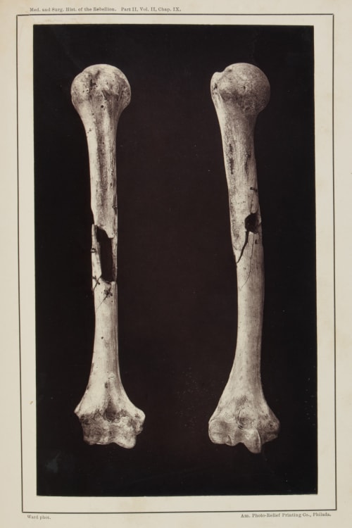 Plate XLVI. Shot Comminutions of the Humeris Ward, E.J.  (American)