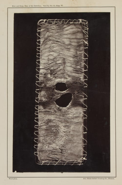  Ward, E.J.  (American)