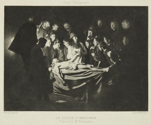 La Lecon D’Anatomie, Négatif de Mr. Alexandre