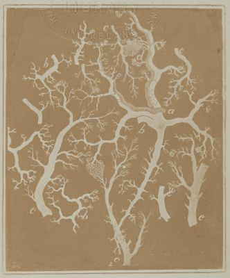 Part of the Surface of an Injected Human Liver