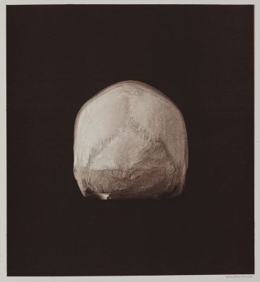 Arrangement for Taking Composite Photographs of Skulls, Photograph No. 1