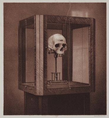 Arrangement for Taking Composite Photographs of Skulls, Photograph No. 1