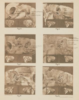 Planche II (overlay)