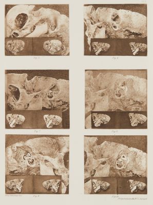 Planche II