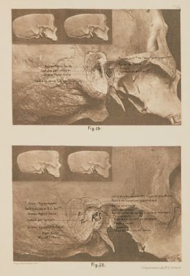 Planche VI (overlay)