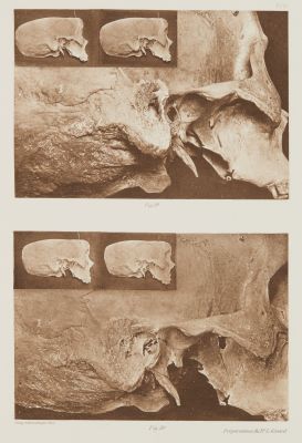 Planche VI