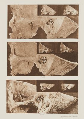 Planche IX