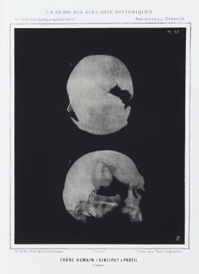 Crâne Humain. 1. Sinciput 2. Profil