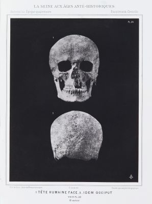 1. Tête humaine face, 2. idem occiput