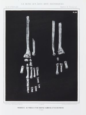 Fragments de radius et de cubitus humains, et os des mains