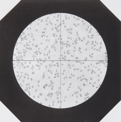 Aspect du Champ du Microscope