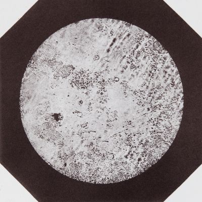 Cellules et Corpuscules Naissants