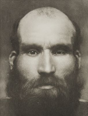 Plate XXXIX, Microphthalmos