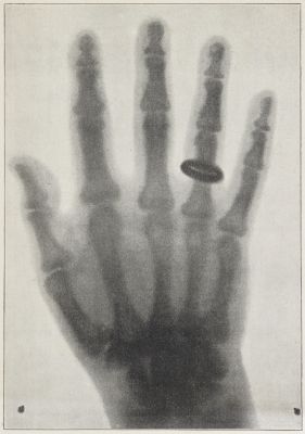 La Decouverte du Dr. Roentgen