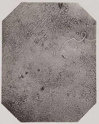 Pl. XVII