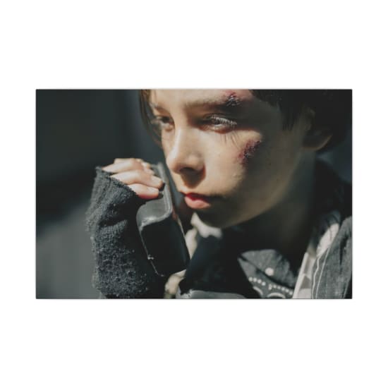 Close-up portrait of a young boy with wounds, using a radio, conveying a survival theme in a post-apocalyptic setting.