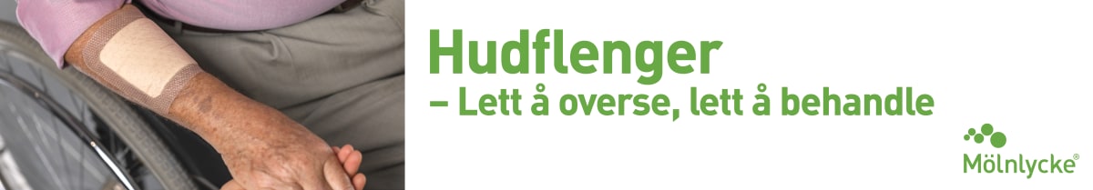 Hudflenger – Lett å overse, lett å behandle