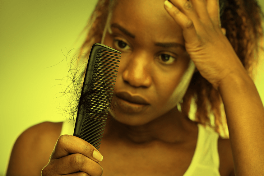 Could Alopecia Be The Reason For Your Hair Loss?