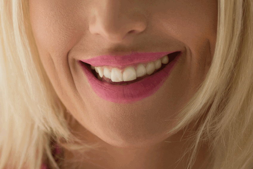 Dental Bonding: The Super-Glue of Smile Enhancement