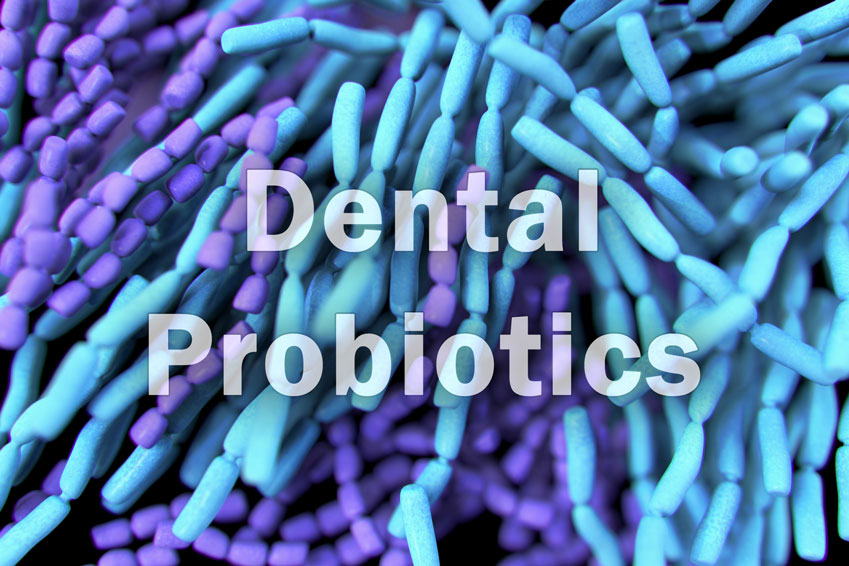 Dental Probiotics Q&A – What do they really do? Anything?