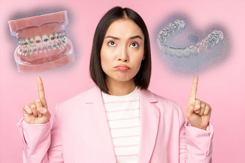 Right type of tooth aligners