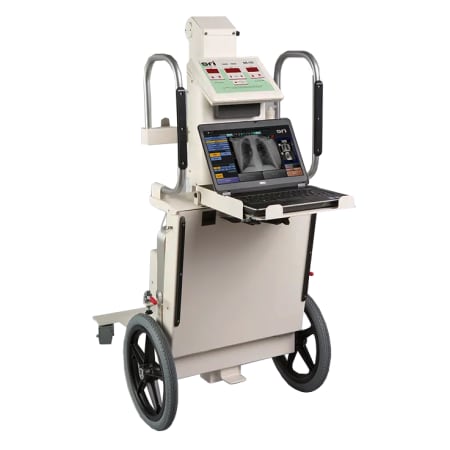 source-ray-sr-130-portable-x-ray-system.jpg