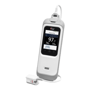 Masimo Rad-G Pulse Oximeter