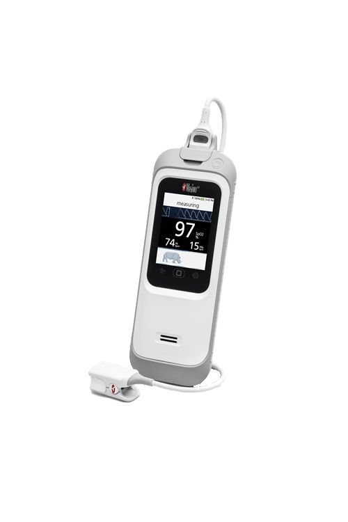masimo-rad-g-pulse-oximeter.png