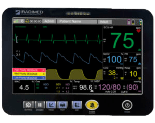 iradimed-3885t-hand-held-remote-tablet.png
