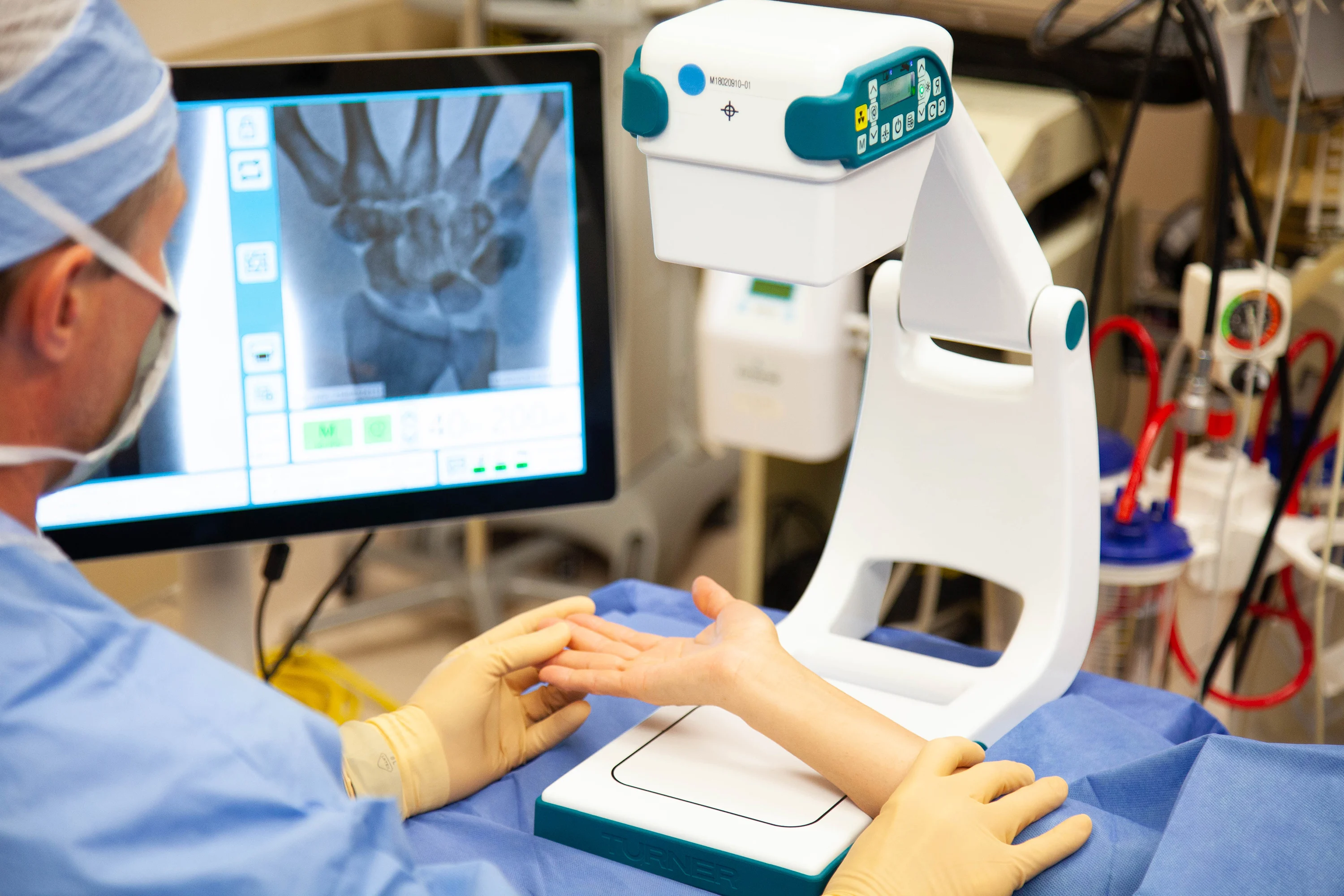 Enhancing Diagnostic Imaging Capabilities in Medical Facilities With C-Arm Machine Rental