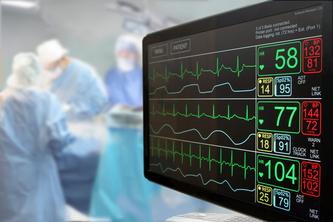 How to Minimize Downtime and Optimize Efficiency With Medical Equipment Rentals