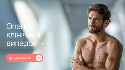Оперізувальний герпес: чому важливо не зволікати з лікуванням та як запобігти ускладненням