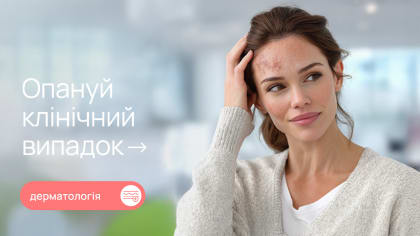 Псоріаз волосистої частини голови: труднощі диференційної діагностики та клінічний випадок