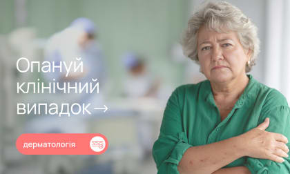 Дерматофітія тулуба: чому не варто відкладати візит до дерматолога