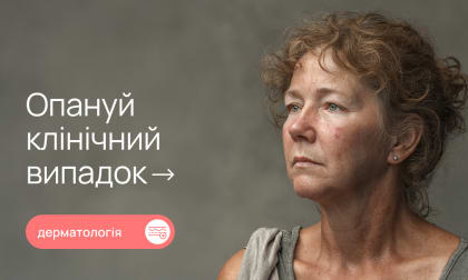 Червона пітниця у дорослих: причини, прояви та клінічний випадок