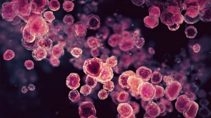 Як виявити та лікувати хромобластомікоз