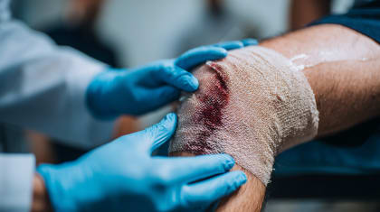 Концепція T.I.M.E.R.S. у лікуванні хронічних ран