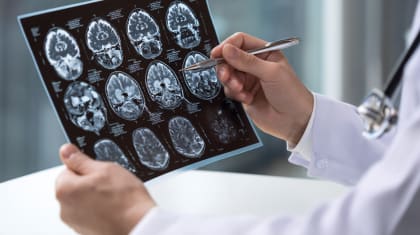 Інсультна допомога у Великій Британії на прикладі Лондонської лікарні