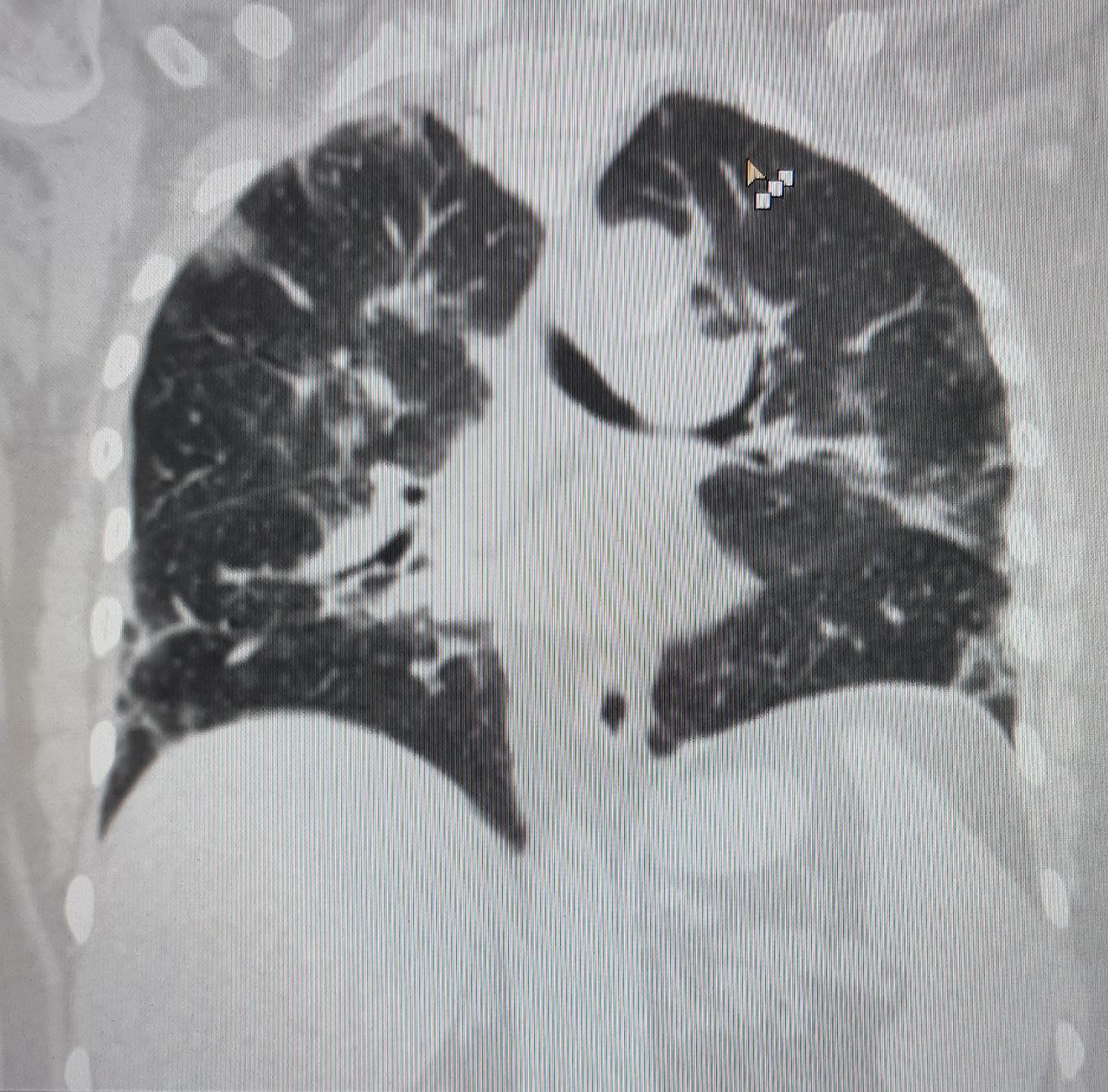 Webinar - xray (1).jpg