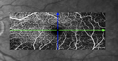 Eye 2.png