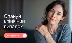Розповсюджений бляшковий псоріаз з системним ураженням: діагностика та тактика ведення