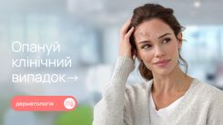 Псоріаз волосистої частини голови: труднощі диференційної діагностики та клінічний випадок