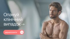 Оперізувальний герпес: чому важливо не зволікати з лікуванням та як запобігти ускладненням