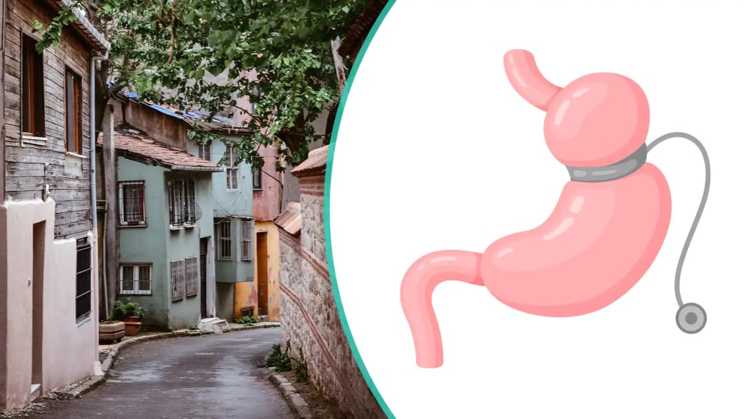 Gastric Band Surgery in Turkey