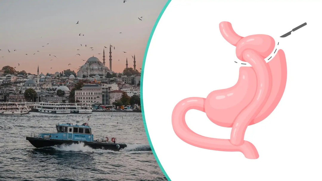 Gastric Bypass Surgery in Turkey