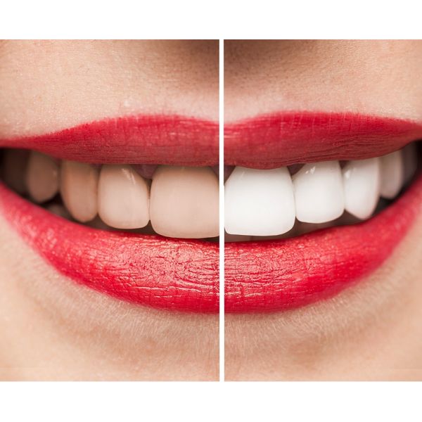 2-Pack: Activated Coconut Charcoal Teeth Whitening Powder