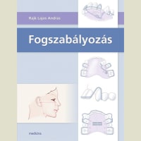 Fogszabályozás