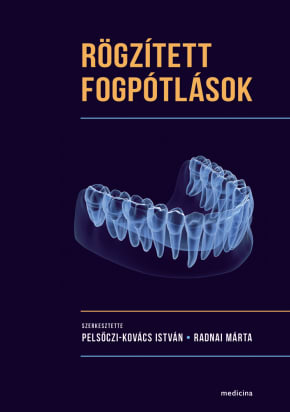 Rögzített fogpótlások 2712 Rögzített fogpótlások 2712